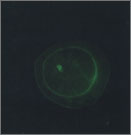 GGehoorsteentjes met een kleurmerk (groene ring) onder fluorescerend licht
